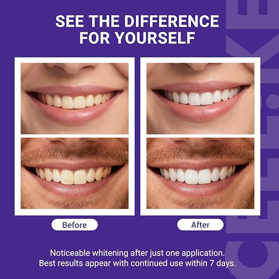 Purple Teeth Whitening Strips – PAP+ & nHAP Dual-Action Tech For Zero-Sensitivity Brighter Smiles