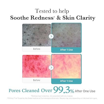 Facial Cleanser – Azelaic Acid & Niacinamide Formula For Clear Blemish-Free Skin